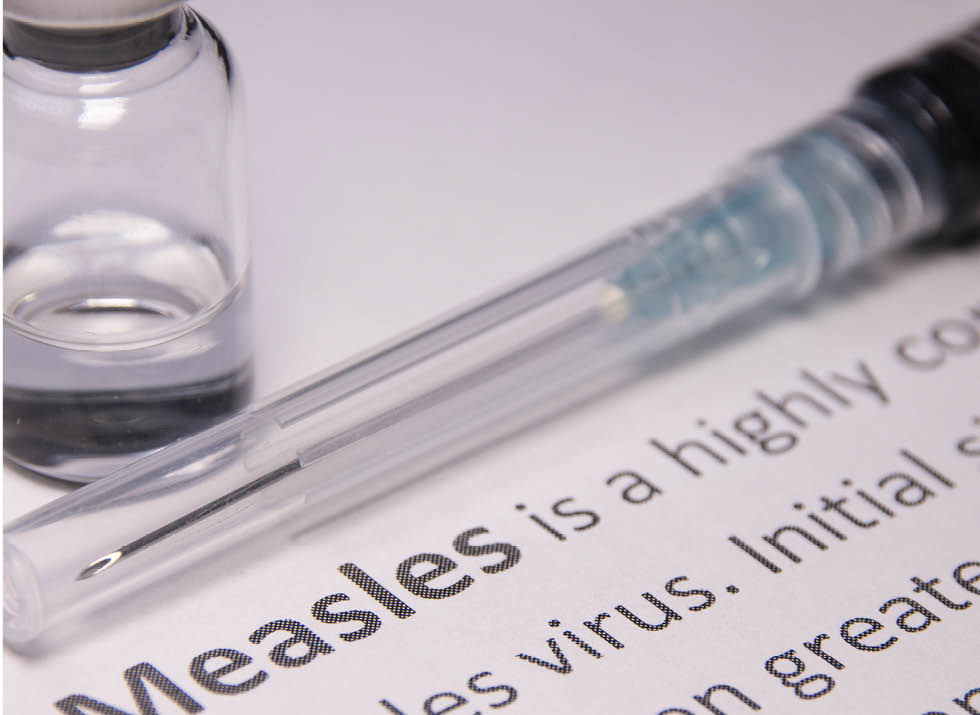 measles
